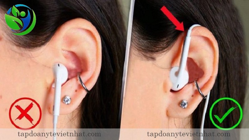 Đeo tai nghe đúng cách để bảo vệ cho tai và não bộ