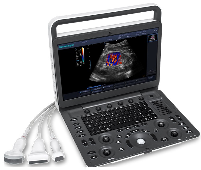 Máy siêu âm SonoScape E3 màn hình 15.6inch SR Flow, Vis-Needle, TDI