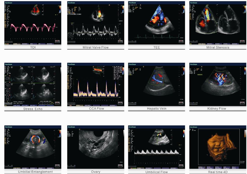Máy siêu âm xách tay SonoScape S8
