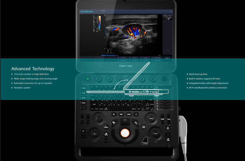 Máy siêu âm xách tay 4D doppler màu SonoScape X5