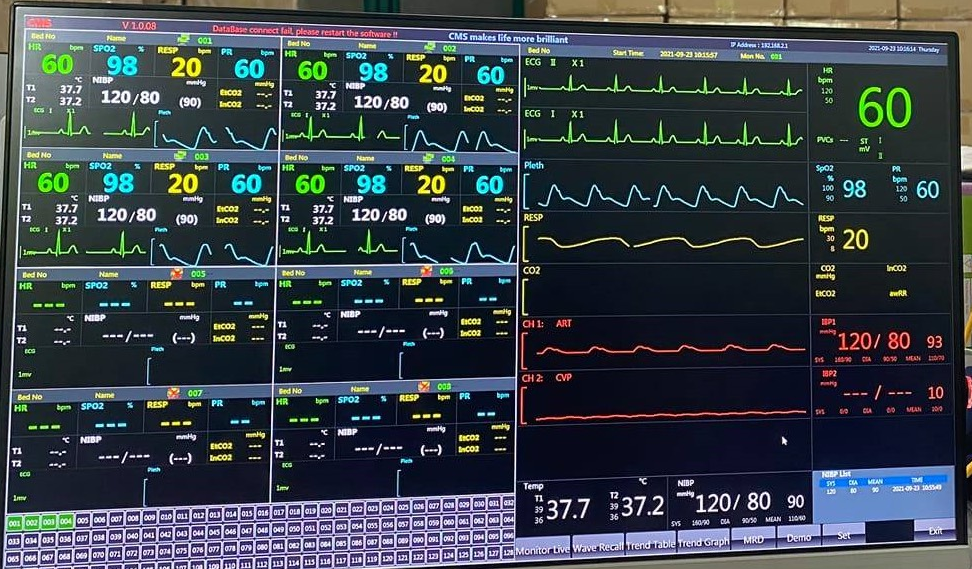 Monitor theo dõi bệnh nhân 5 thông số Contec CMS9000