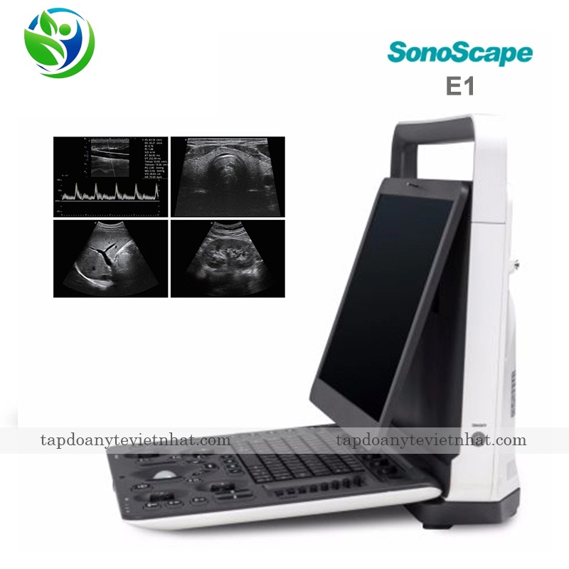 Máy siêu âm 2D đen trắng SonoScape E1