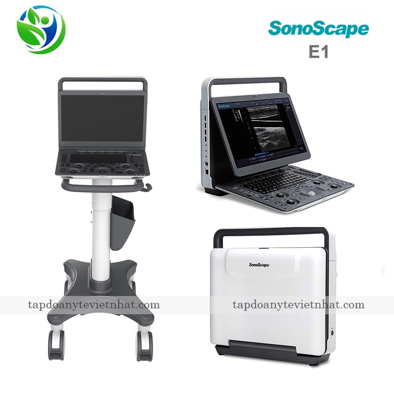 Mẫu máy siêu âm SonoScape E1