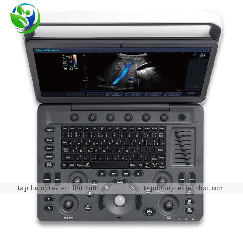 Hình ảnh máy siêu âm 2D SonoScape E2 Pro