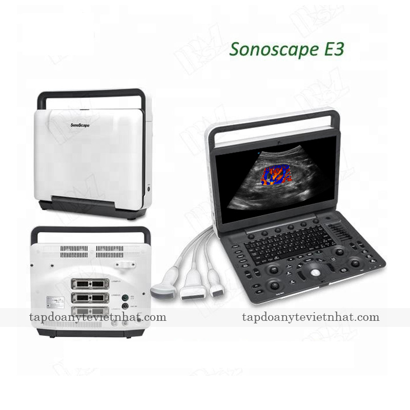 Tổng quan máy siêu âm 2D SonoScape E3