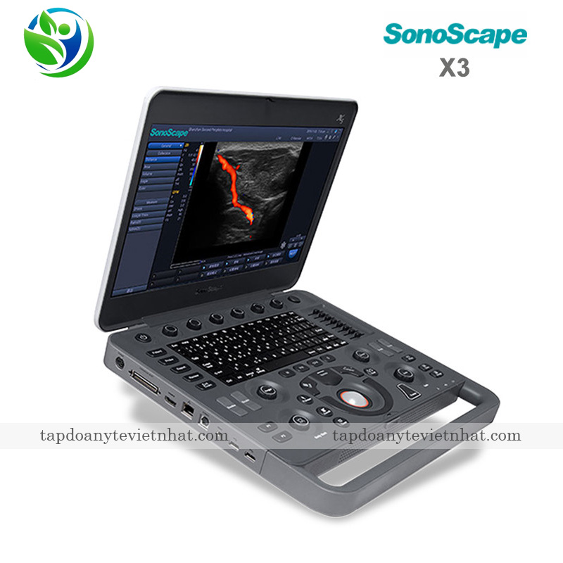 Máy siêu âm SonoScape X3 kiểu dáng nhỏ gọn