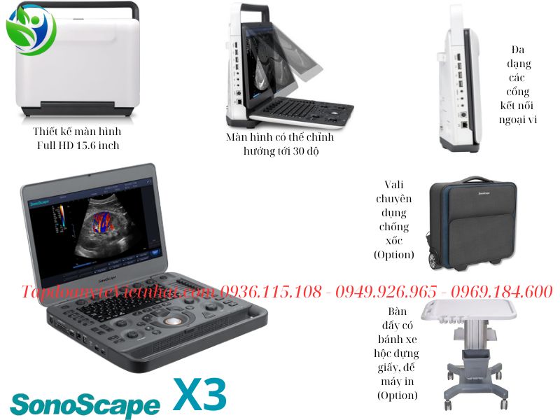 Máy siêu âm 2D SonoScape X3