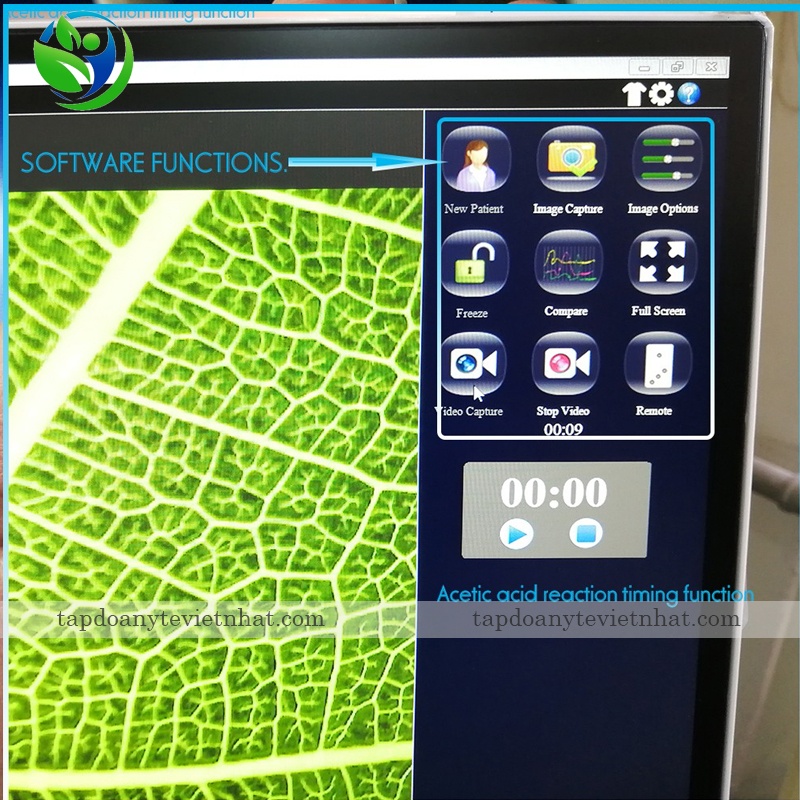 Phần mềm soi cổ tử cung Kernel KN-2200 màn hình ph