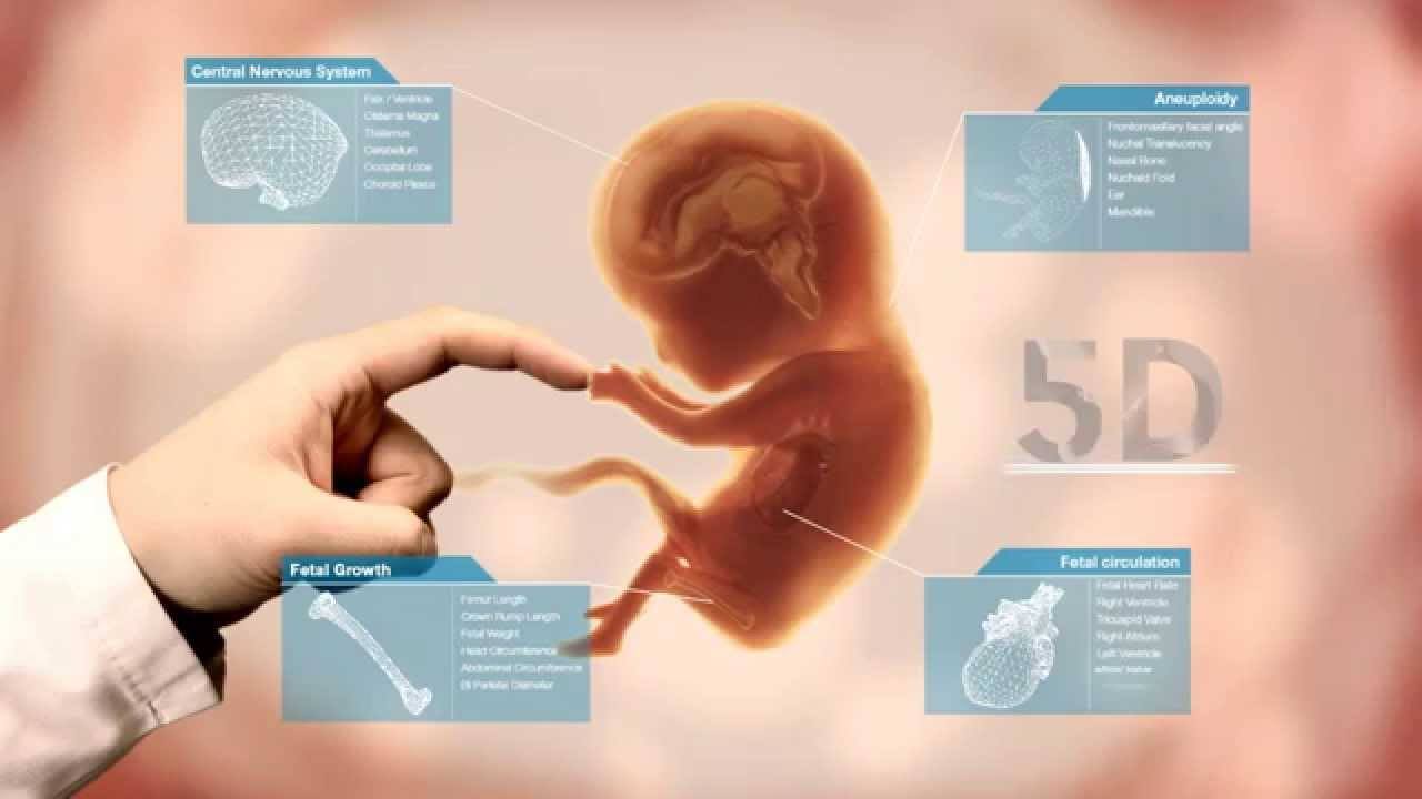 hệ thống siêu âm 5d
