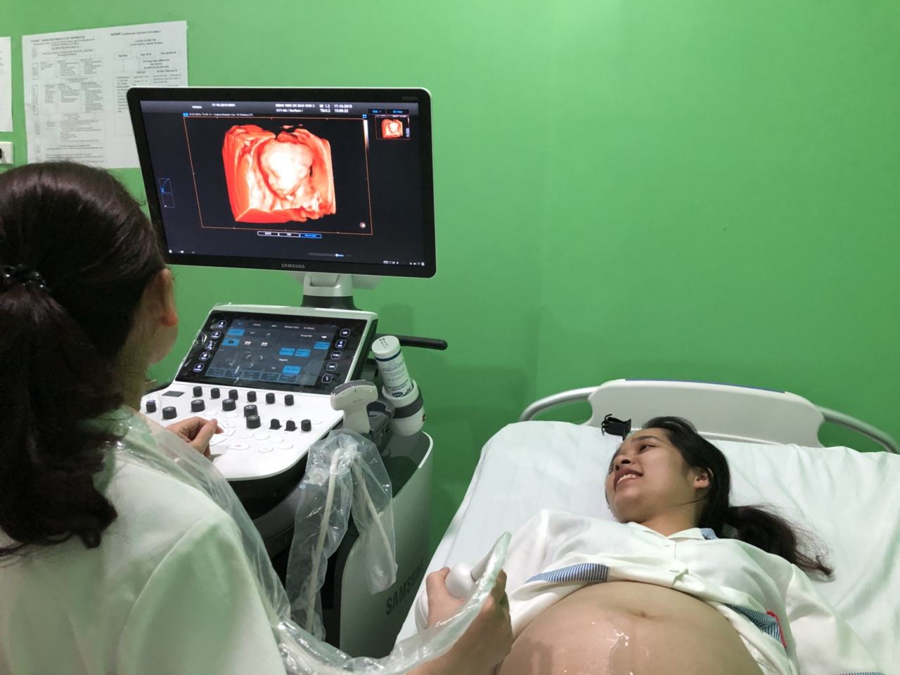 máy siêu âm 5d công nghệ 4.0
