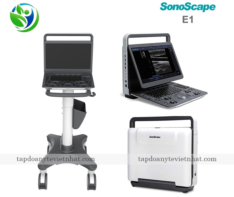 SonoScape E1 có khả năng tích hợp bàn đẩy