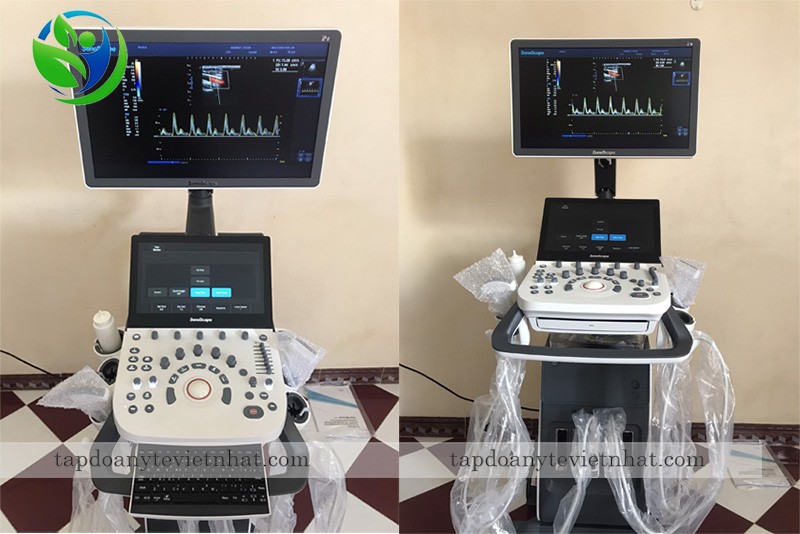 Ảnh thực tế SonoScape P9 Việt Nhật