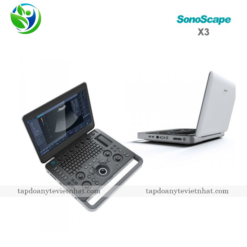 SonoScape X3 có thể dễ dàng được mang đi trong các chuyến công tác