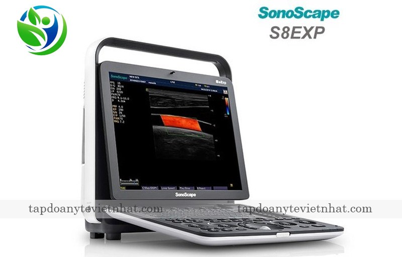 Mẫu máy siêu âm xách tay SonoScape S8 Exp