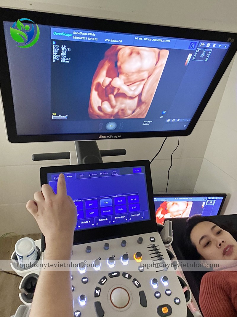 Máy siêu âm được ứng dụng rất nhiều khi theo dõi thai nhi