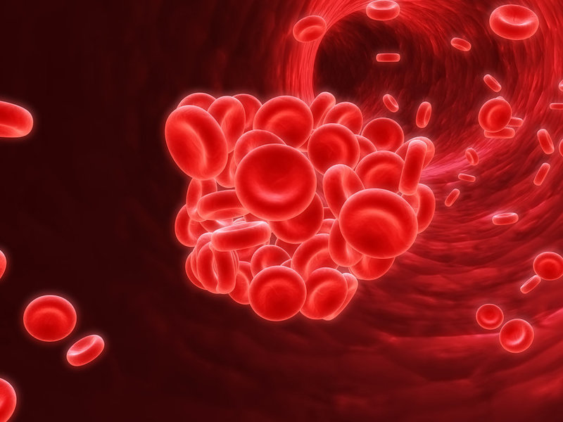 Căn bệnh đa hồng cầu là gì?