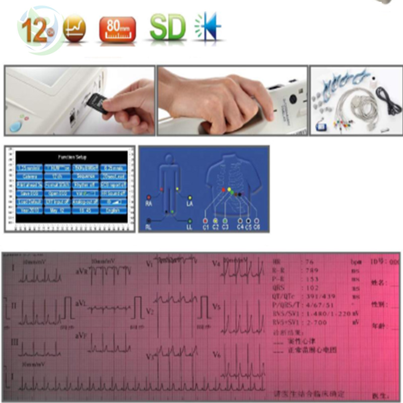 Tính năng của Zoncare ZQ-1203G