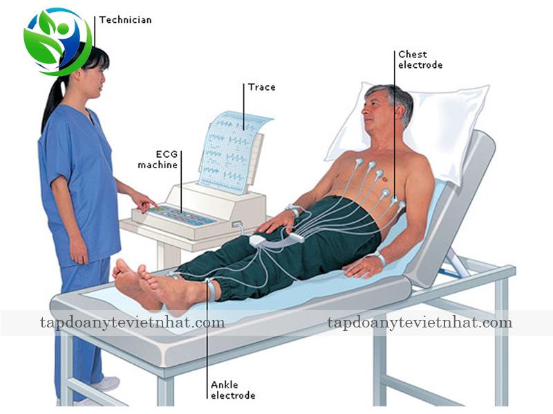 Các điện cực được gắn vào ngực, tay, chân bệnh nhân