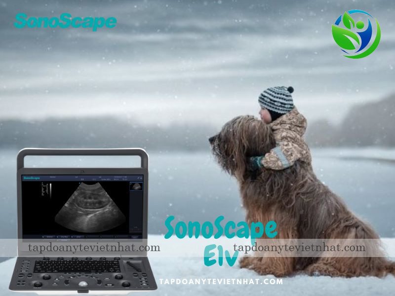 Ảnh minh họa SonoScape E1V