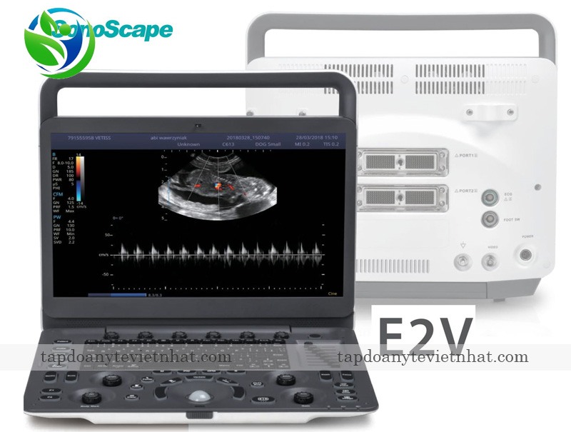 Hình ảnh máy siêu âm thú y SonoScape E2V