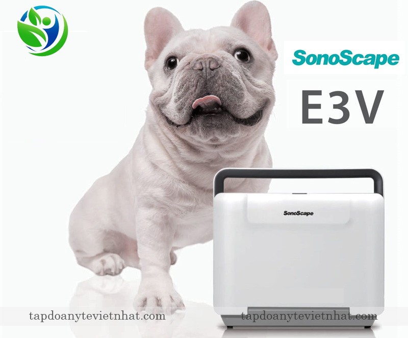 Siêu âm SonoScape E3V