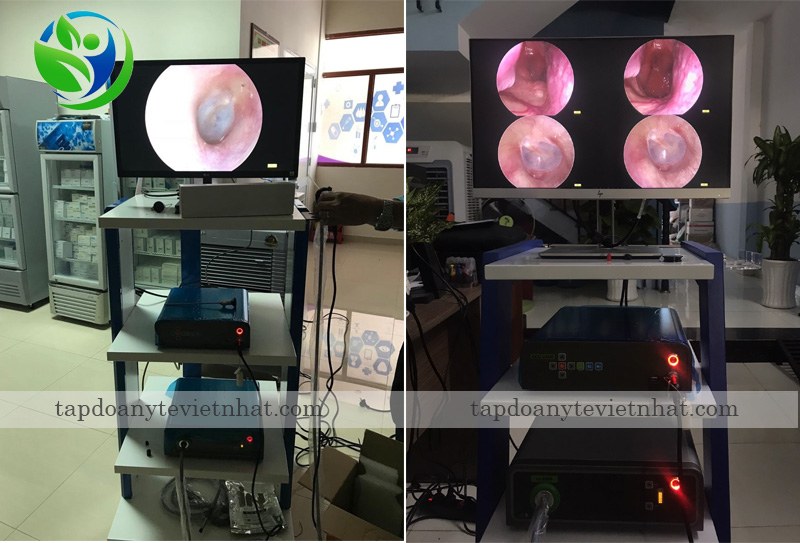 Ảnh lắp đặt Provix CCU-2400