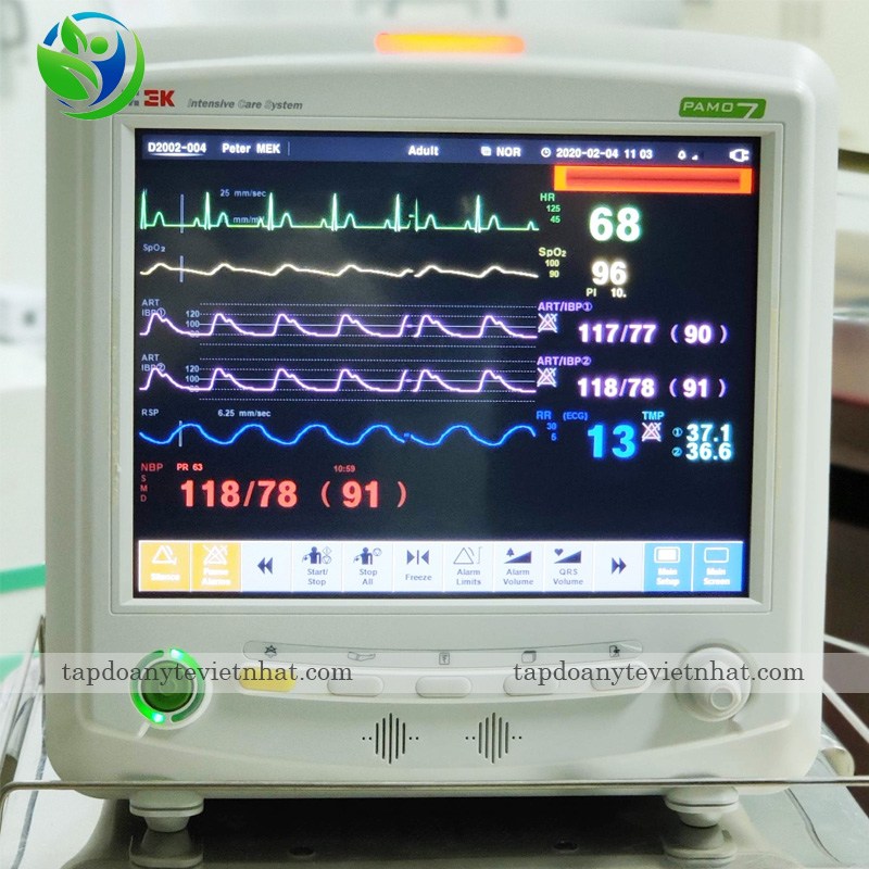 Các dạng sóng trên monitor bệnh nhân