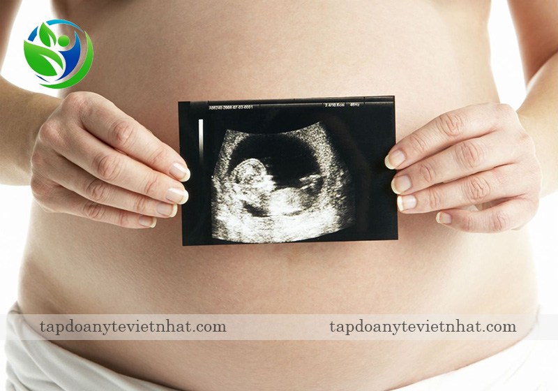  Siêu âm thai 4 tuần biết được kích thước và vị trí làm tổ