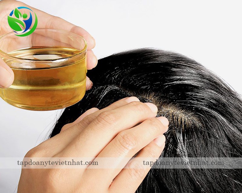  Dầu dừa giúp da đầu ẩm, mềm, giúp tóc phát triển tốt
