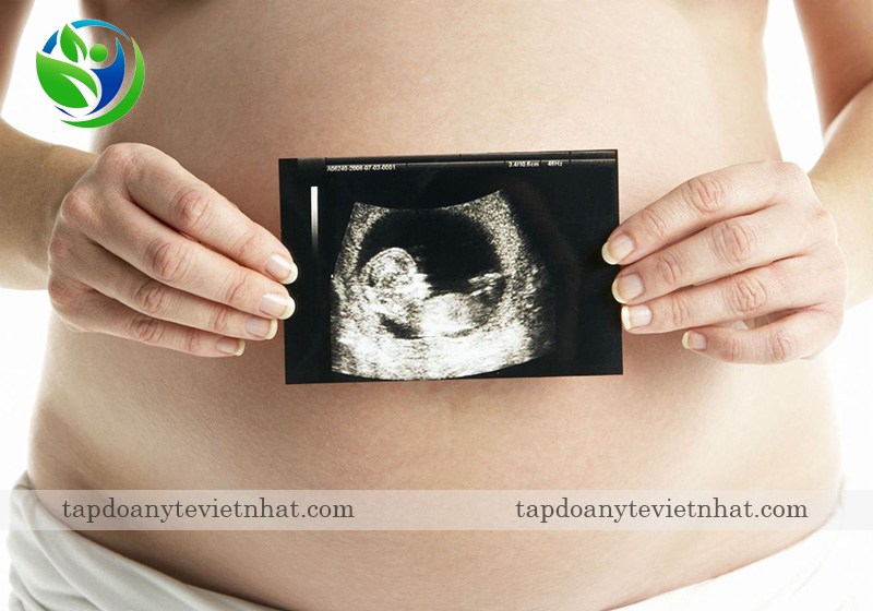 Mẹ bầu nên siêu âm thai định kỳ từ tuần 16 - 20