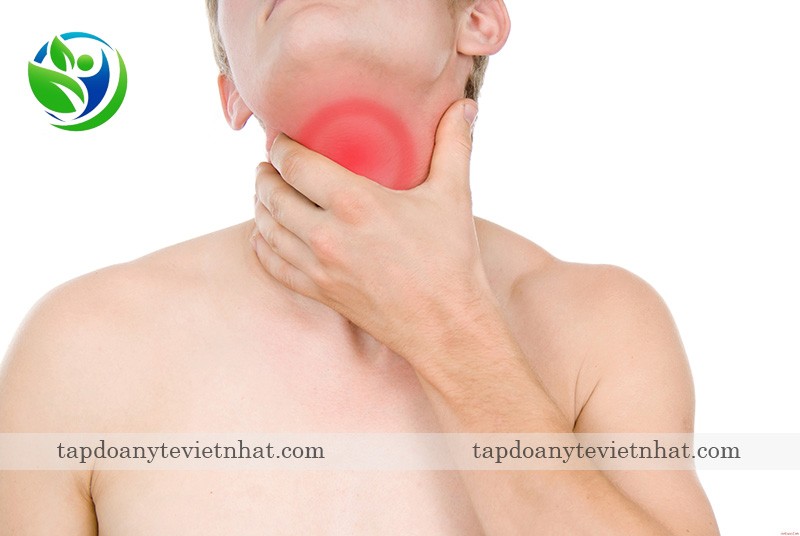 đau họng là dấu hiệu của viêm amidan hốc mủ