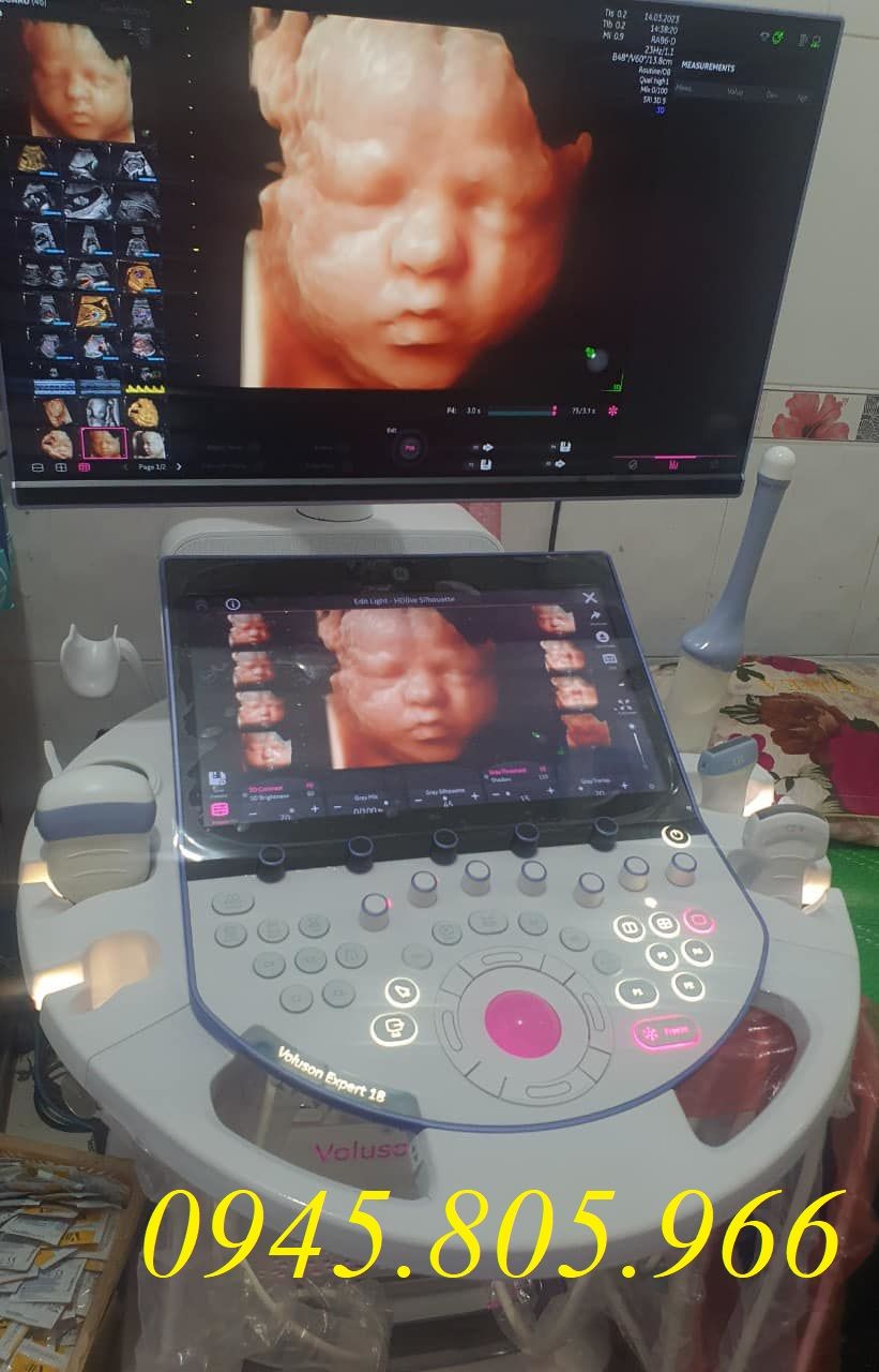 MÁY SIÊU ÂM