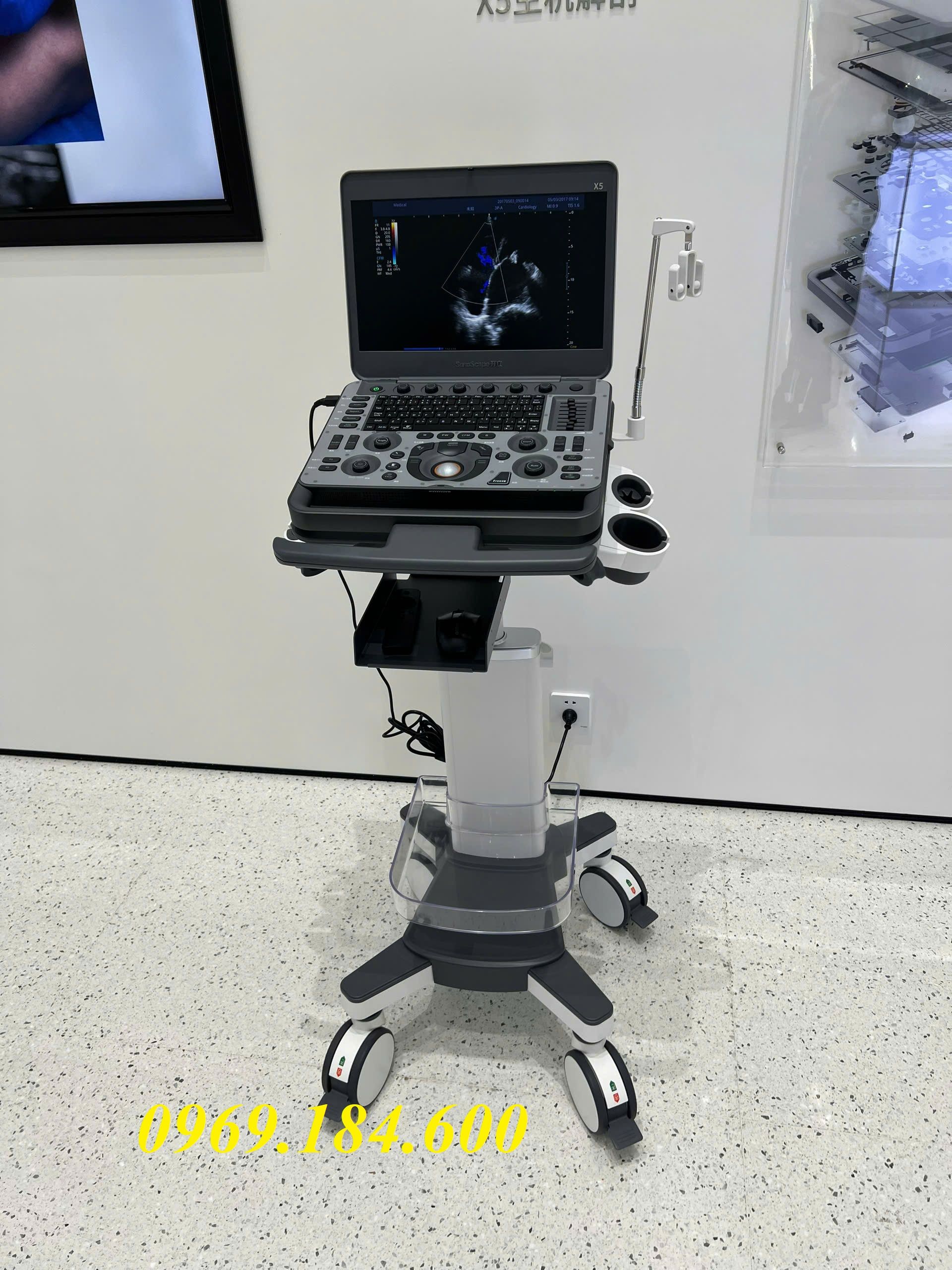 Máy siêu âm xách tay 4D doppler màu SonoScape X5