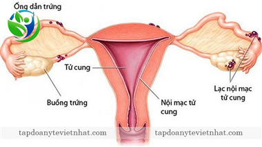 Siêu âm buồng trứng khi nào? Nó có cần thiết cho nữ giới?