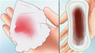 1 Viêm cổ tử cung nhẹ - nguyên nhân và cách điều trị