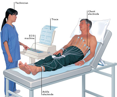 Hướng dẫn cách đo điện tim theo đúng quy trình của Bộ Y tế quy định