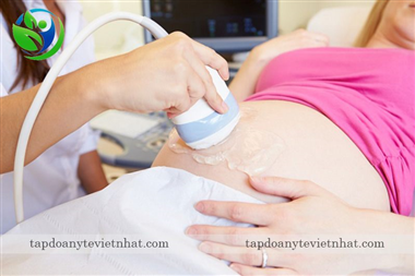 Thông tin cần thiết dành cho mẹ bầu khi siêu âm Doppler thai nhi