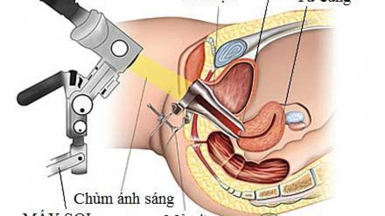 Soi cổ tử cung có đau không