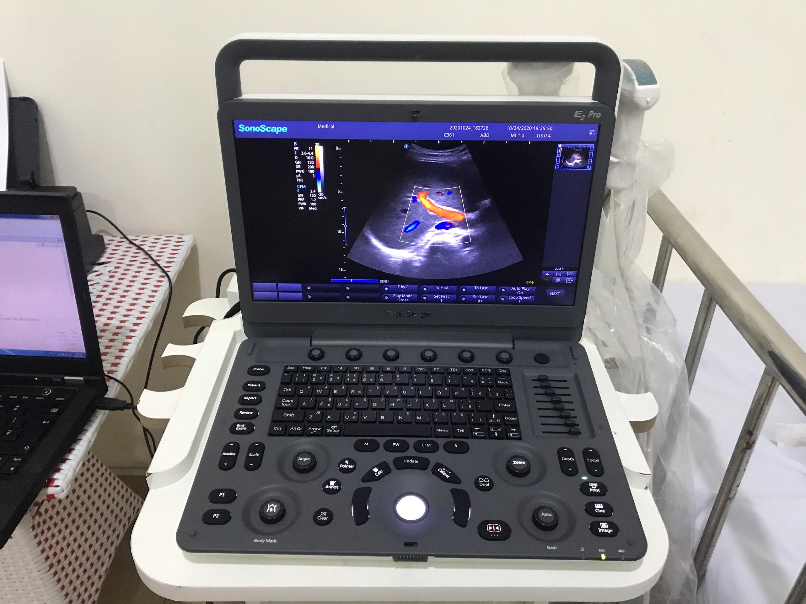 Dòng máy siêu âm Sonoscape bán chạy nhất hiện nay