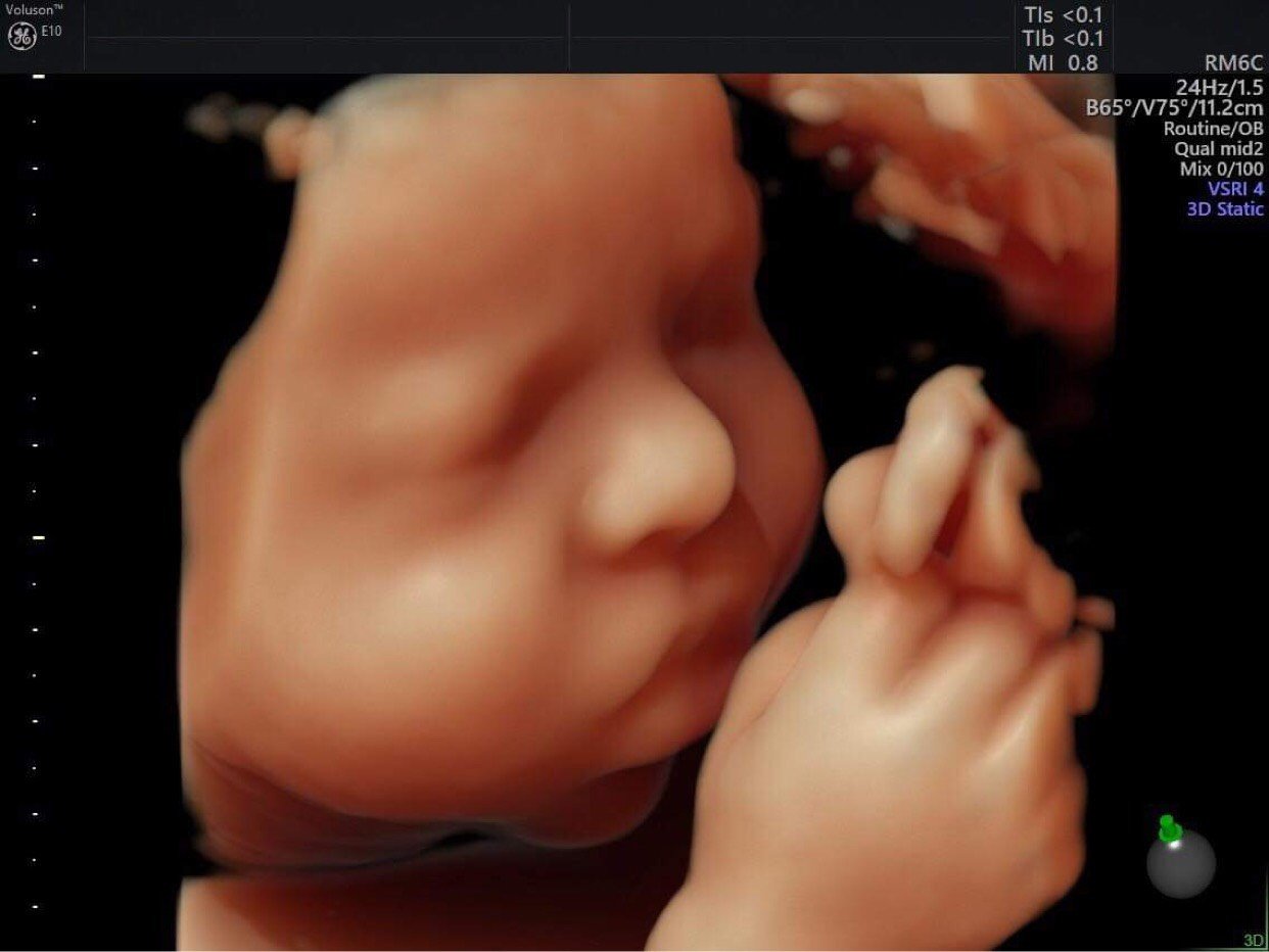 Siêu âm 4D: Với siêu âm 4D, bạn sẽ được thấy con bạn dưới góc nhìn hoàn toàn mới. Hình ảnh siêu âm sắc nét và chi tiết, giúp bạn nhìn rõ từng đường nét trên khuôn mặt và cả vật phẩm của thai nhi.