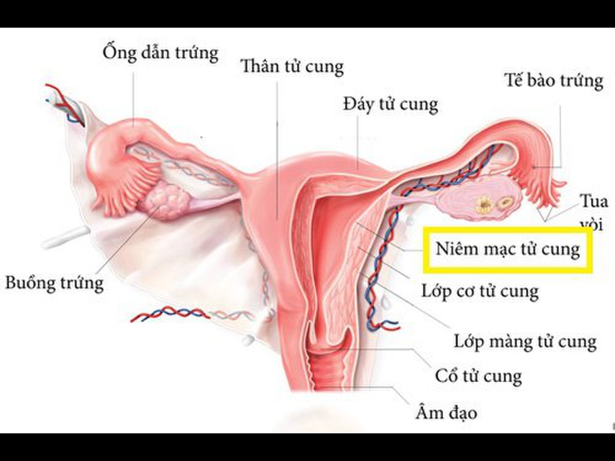 Vết trắng cổ tử cung